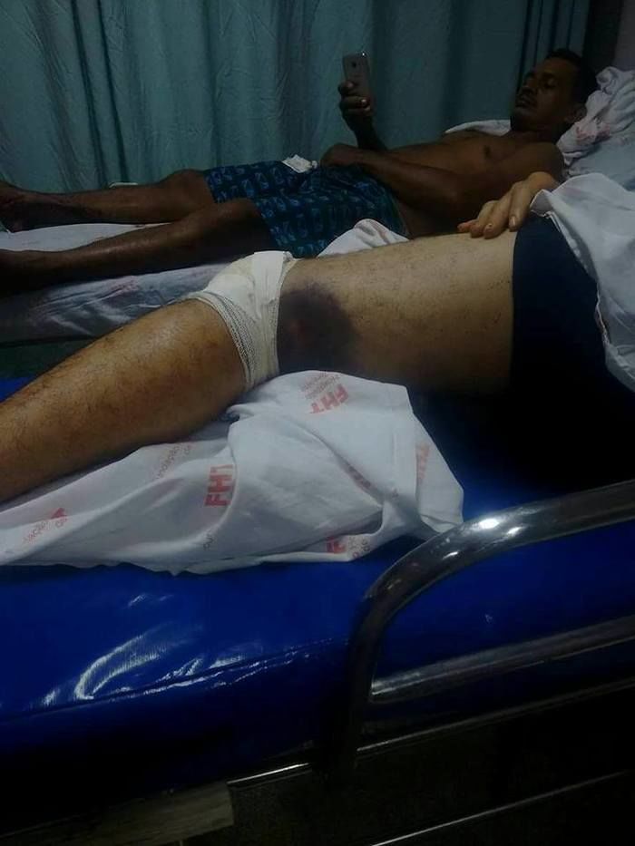 Jovem ficou hospitalizado em Barras (Crédito: Tribuna de Barras)
