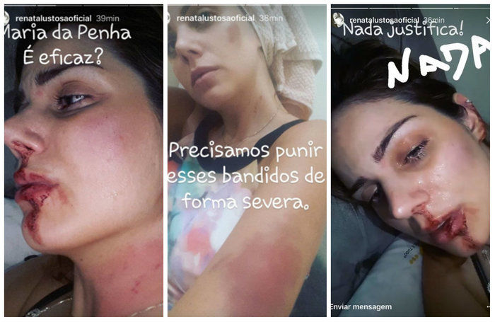  Renata Lustosa postou fotos em que aparece com o rosto ensanguentado (Crédito: Reprodução)