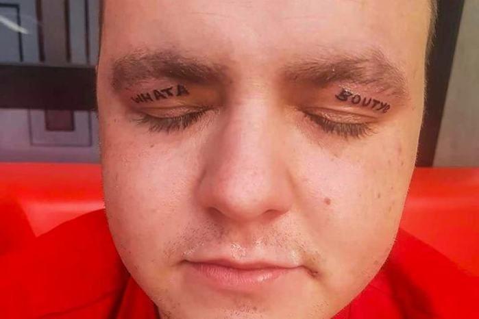Após despedida de solteiro homem acorda com tatuagens nas pálpebras