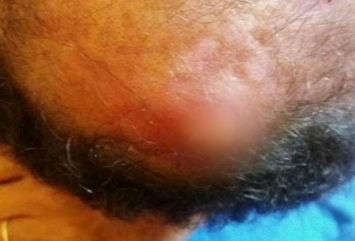 Tendo deixado a fumagem que se melhorará