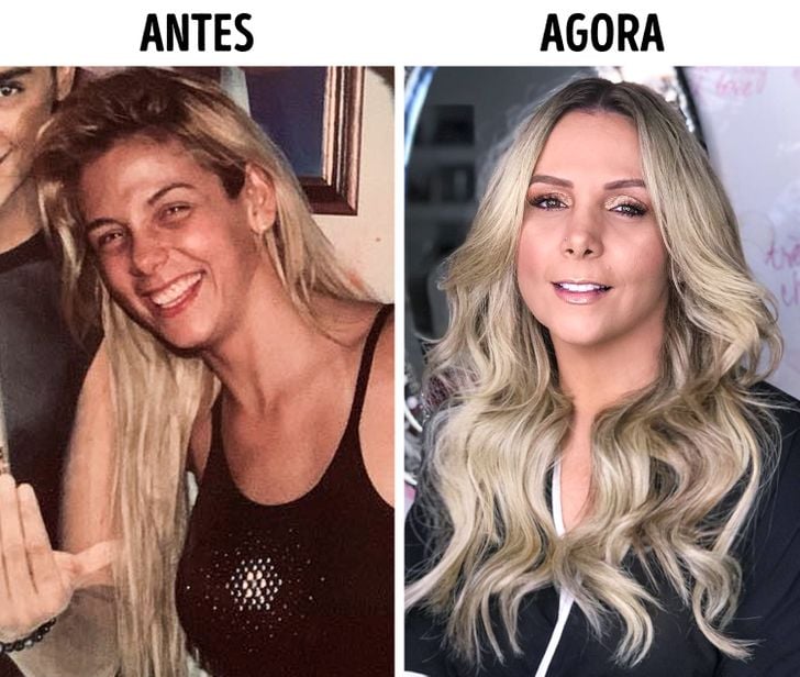 Confira O Antes E Depois Das Cirurgias Pl Sticas De Famosas