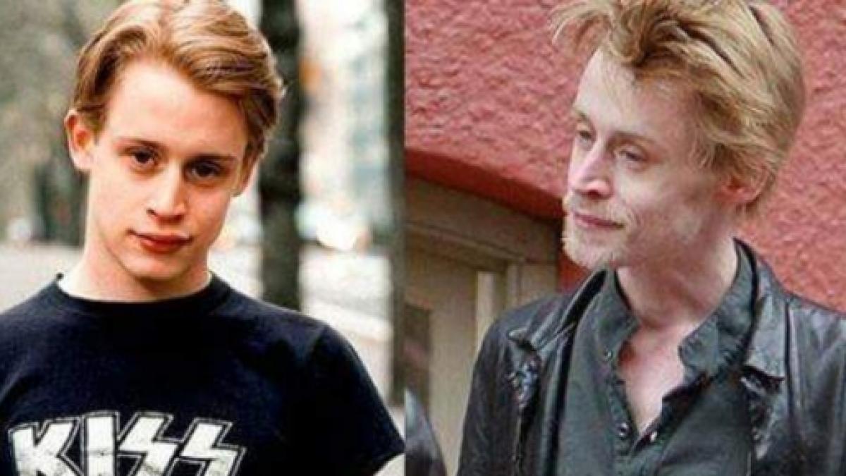 Veja o antes e depois de celebridades após uso das drogas meionorte