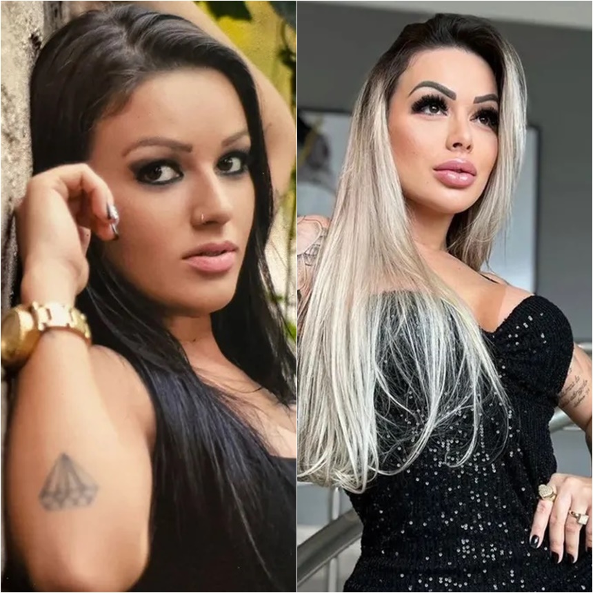 Após plásticas influencer diz Famosas fazem só não contam