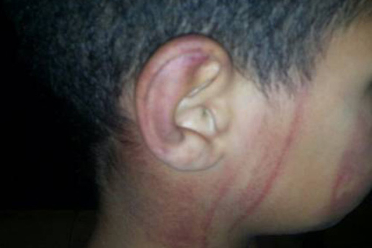 Padrasto tortura criança por ordens da mãe: "não sei educar"