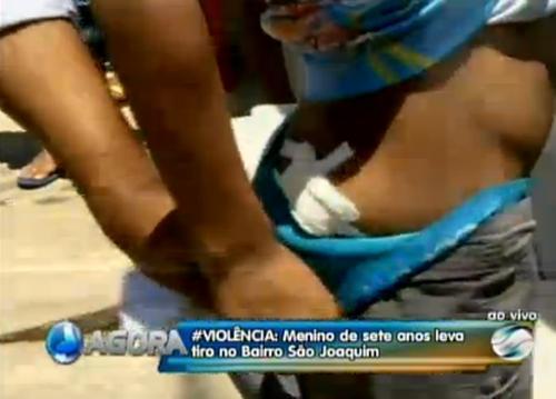 "Doeu muito", afirma criança atingida por tiro nas nádegas