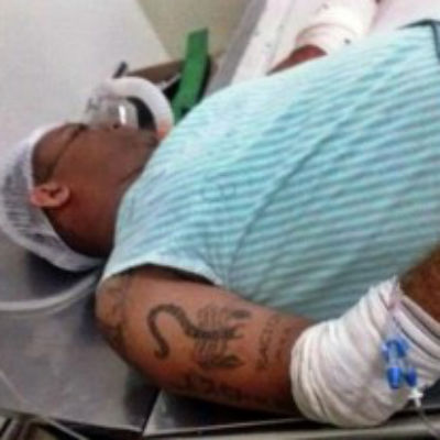 Homem é alvejado com tiros na barriga e no braço por desafeto no interior do Piauí
