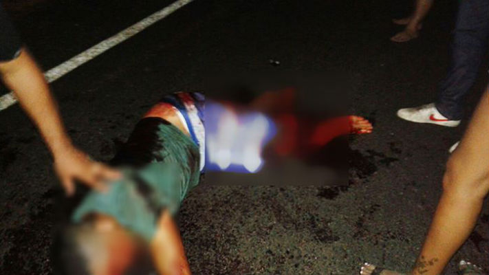 Jovem tem perna dilacerada após acidente na zona rural de Altos