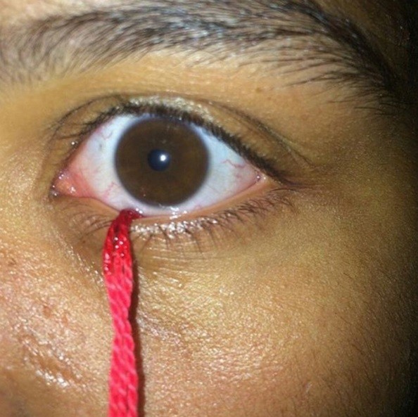 Pessoas colocam objetos nos olhos (Crédito: Divulgação Instagram )