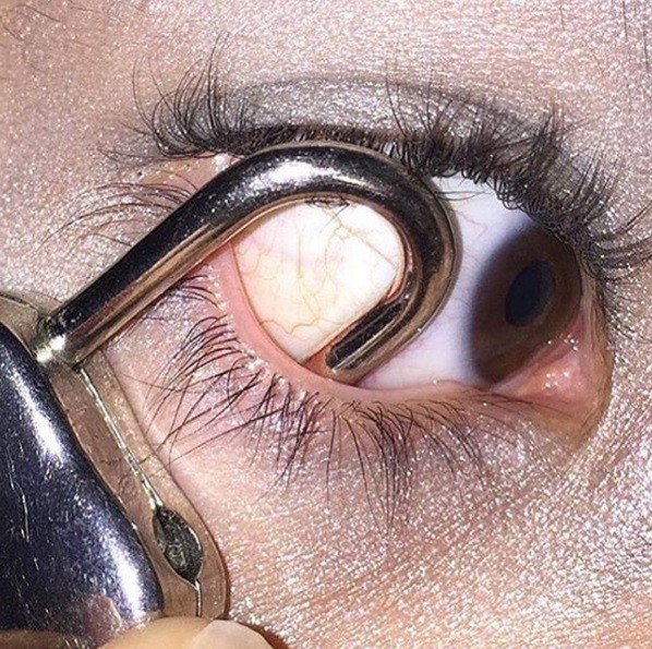 Pessoas colocam objetos nos olhos (Crédito: Divulgação Instagram )