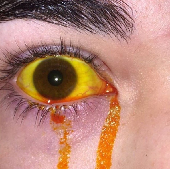 Pessoas colocam objetos nos olhos (Crédito: Divulgação Instagram )