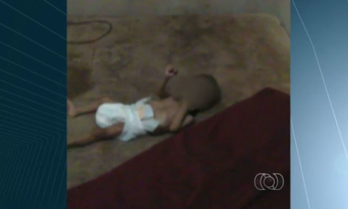 A bebê está internada em estado grave com sinais de desnutrição (Crédito: Reprodução)