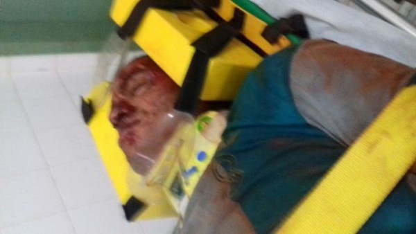 Lavrador ficou gravemente ferido (Crédito: Reprodução)