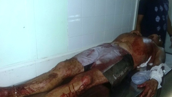 Homem ferido a golpes de faca (Crédito: Reprodução)