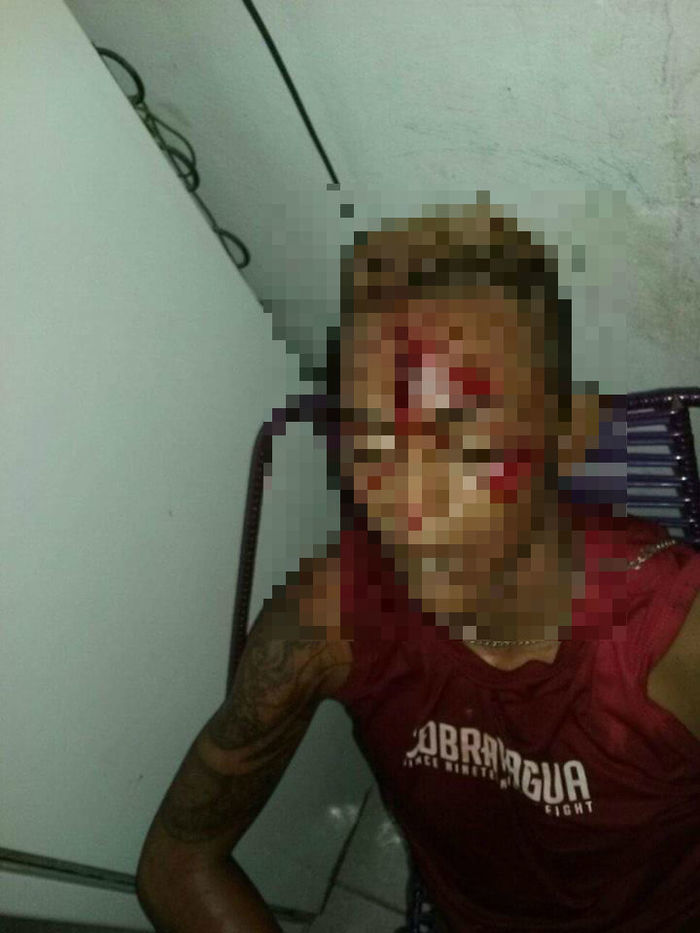 Jovem recebeu um tiro na testa (Crédito: Reprodução)
