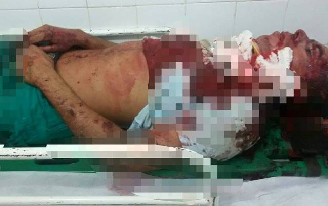 O rapaz foi encaminhado para o Hospital de Urgência de Teresina (Crédito: Reprodução)
