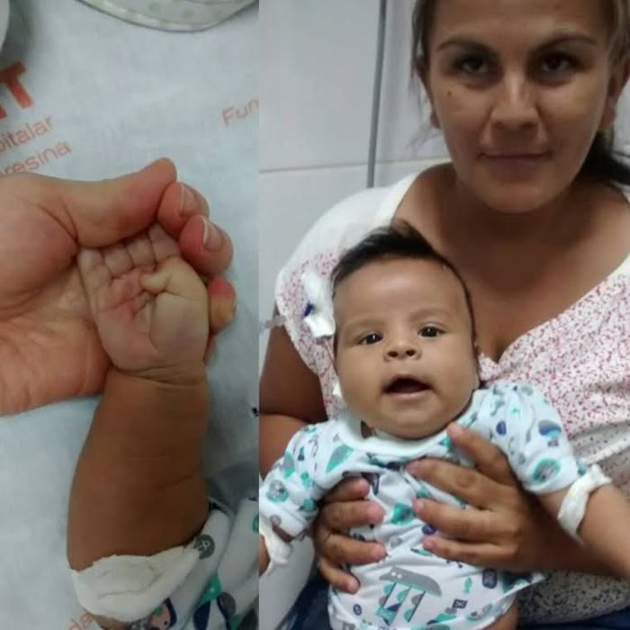 Bebê precisa de sangue "A Negativo"