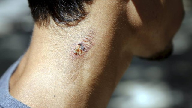 Jovem denunciou tortura (Crédito: Reprodução)