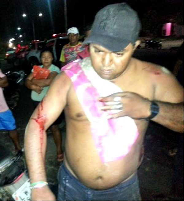 Homem vai parar embaixo de carro e diz que capacete salvou sua vida em Piripiri; veja o vídeo