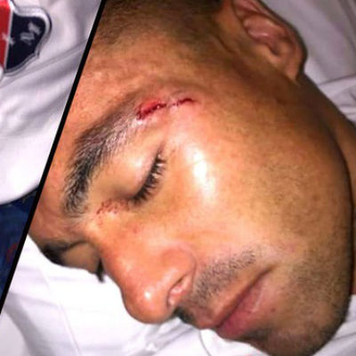 Jogador é ferido com pedrada durante ataque de torcedores após jogo