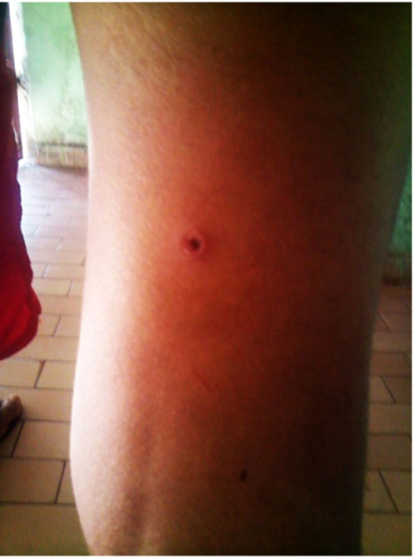 Menor é baleado com um tiro de espingarda após ser vítima de emboscada