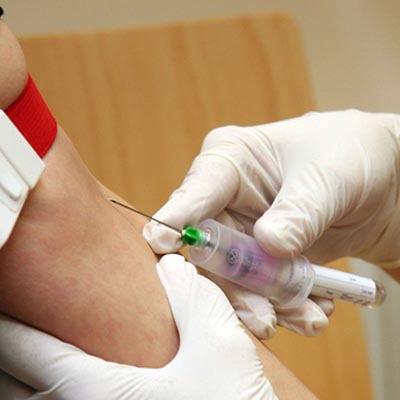 HIV: Nova vacina contra o vírus será testada na África do Sul