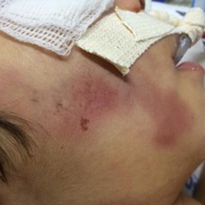 Mãe suspeita de espancar filho se justifica: "Fez cocô na cama e eu me estressei"
