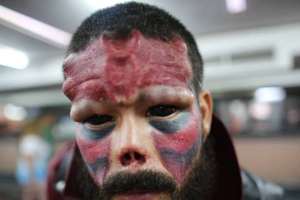 Homem que cortou nariz para parecer vilão de filme diz que fará novas deformações no corpo