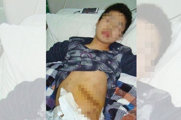 Estudante tem baço removido após ser atacado por professor