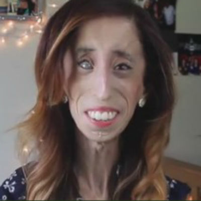 Mulher chamada de "mais feia do mundo" fala sobre bullying em filme