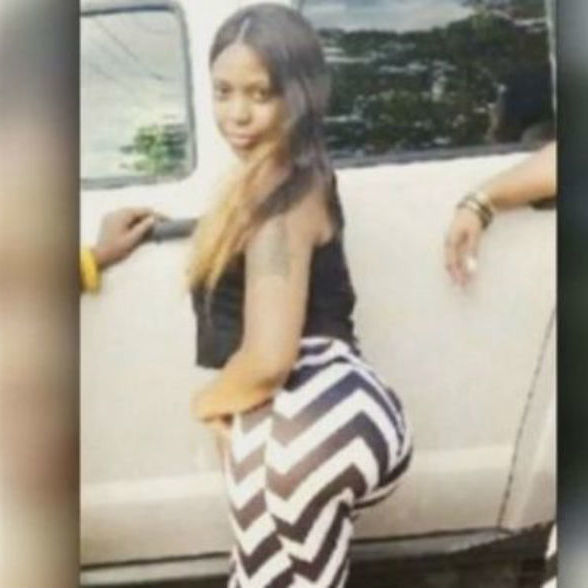 Mulher morre depois de tomar quarta injeção para aumentar bumbum