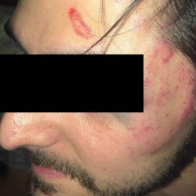 Ativistas LGBT denunciam agressão após protesto contra homofobia em Botafogo