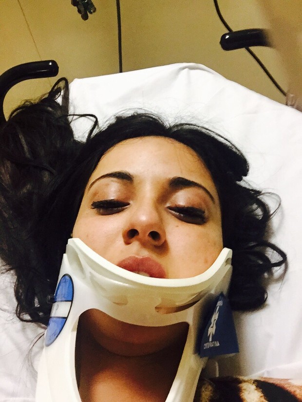 "Quase morri", diz ex-namorada de Ken humano após sofrer acidente