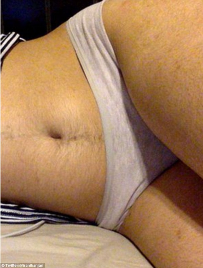Jovem postou uma foto sensual nas redes sociais (Crédito: Reprodução)
