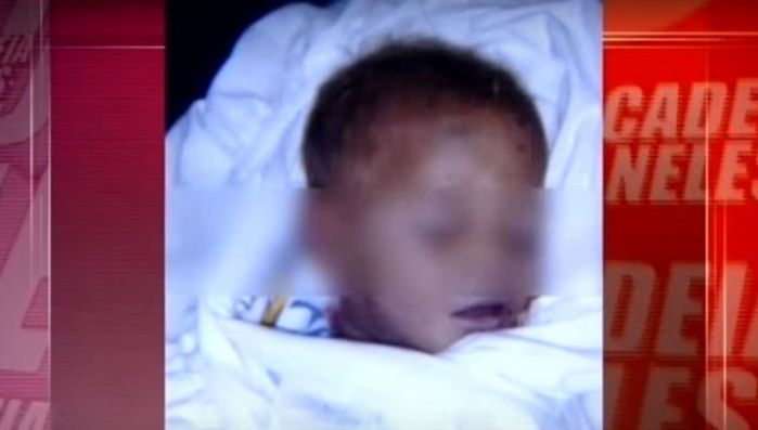 Criança morreu engasgada (Crédito: Reprodução)