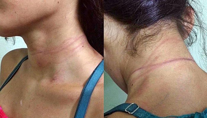 Jovem espancada pelo próprio companheiro em Piracuruca