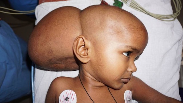 Renu antes da cirurgia (Crédito: Reprodução)