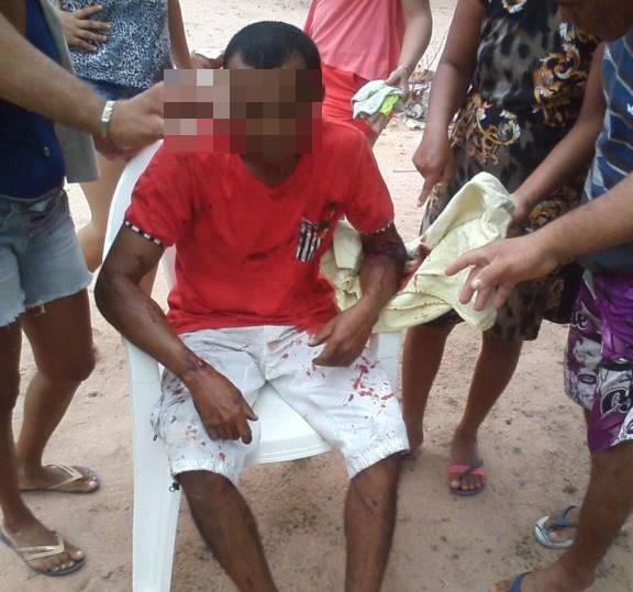 Briga entre familiares deixa feridos (Crédito: Folha de Parnaíba)