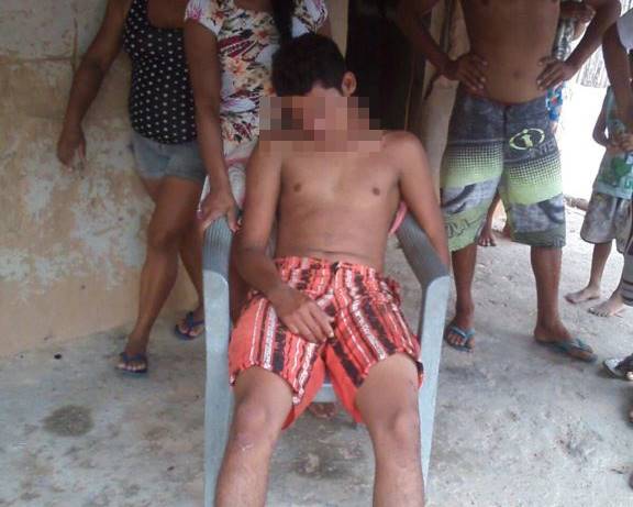 Briga entre familiares deixa feridos (Crédito: Folha de Parnaíba)