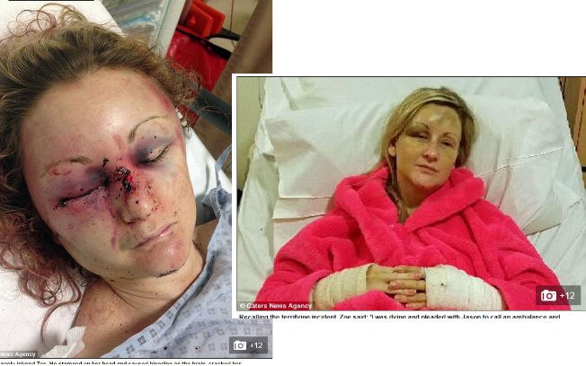Zoe após ser agredida pelo namorado