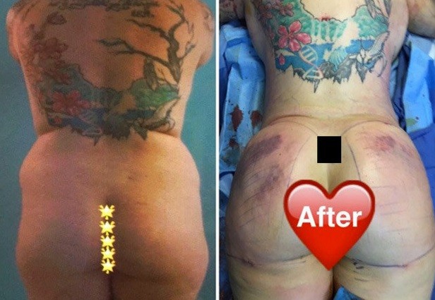 Antes e depois (Crédito: Reprodução)