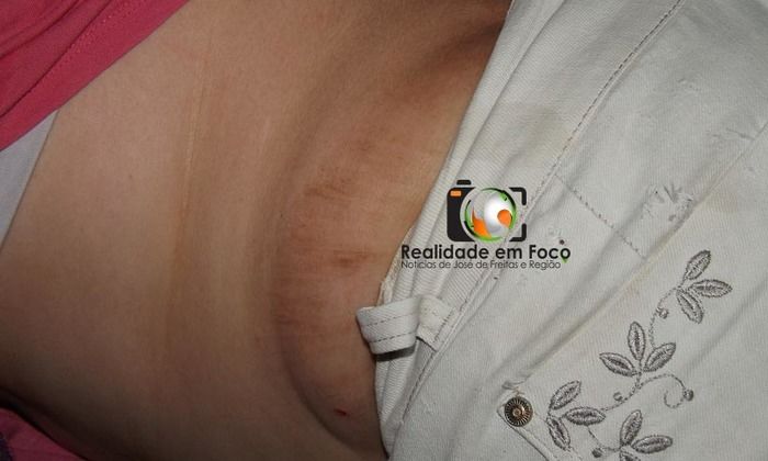 Mulher ficou caída no chão após os ferimentos (Crédito: Reprodução)