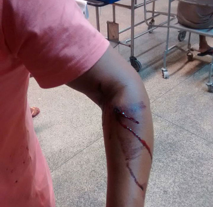 Sargento baleado durante asalto na zona Sul