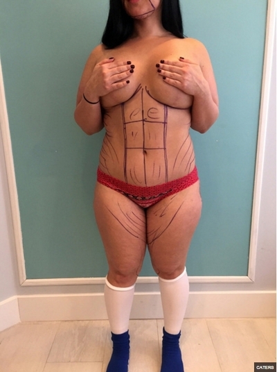 Marlene Chinea antes da cirurgia (Crédito: Reprodução)