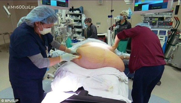 Nikki Webster passou por cirurgia de redução de estômago.
