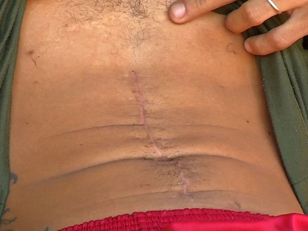 Homem foi internado em MT para retirar bala da coluna e saiu do hospital sem um rim (Crédito: Reprodução)