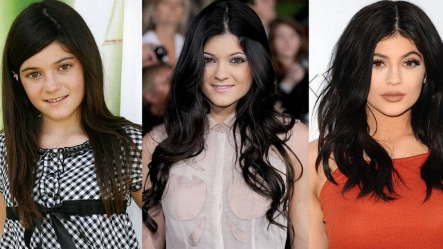 ‘Não queria ser uma má influência’, afirma Kylie Jenner sobre preenchimento labial