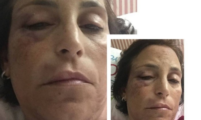 Mulher relatou agressão (Crédito: Reprodução)