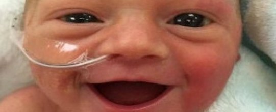 Foto de bebê prematuro sorrindo bomba na internet