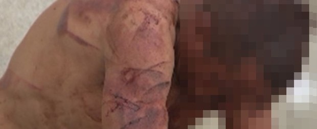 Homem espancado nega abuso a menina de 7 anos