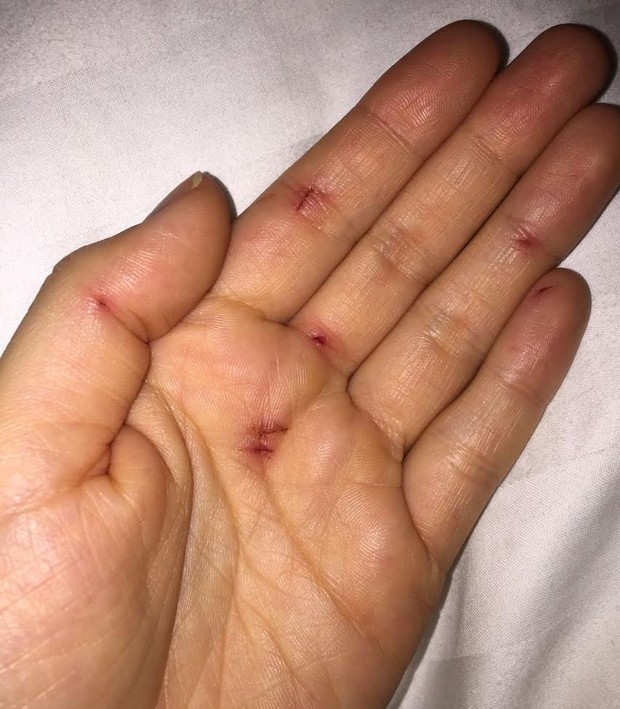 Rayanne Morais passou por maus bocados (Crédito: Reprodução/ Instragram)